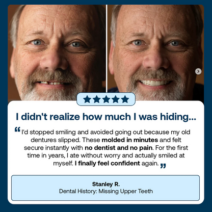 👑2026 Hot Sale Ends Today: 70% OFF!  Custom Custom-Fit Full Functional DenturesMake you more confident – Made in the USA