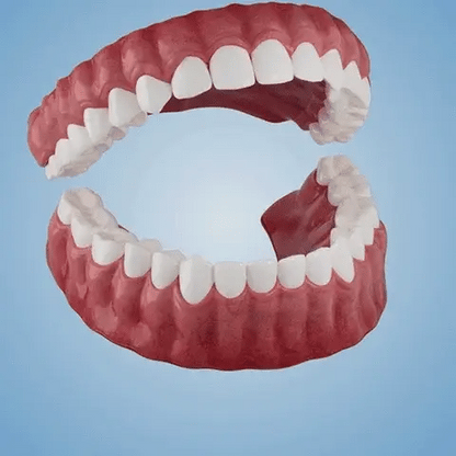 👑2026 Hot Sale Ends Today: 70% OFF!  Custom Custom-Fit Full Functional DenturesMake you more confident – Made in the USA