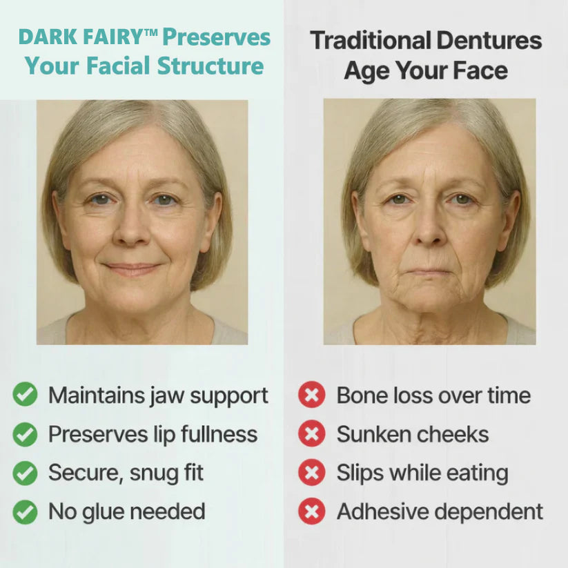 👑2026 Hot Sale Ends Today: 70% OFF!  Custom Custom-Fit Full Functional DenturesMake you more confident – Made in the USA
