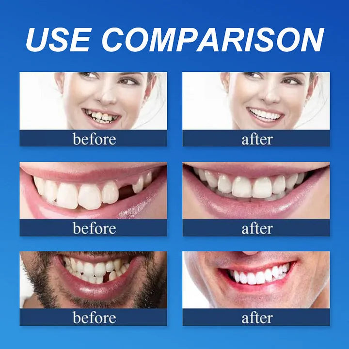 🏆Ends Today: 75% OFF! ⏰DarkFairy™ Medical Full Denture with Strong Suctiond Custom-Fit Full Functional Dentures🦷
