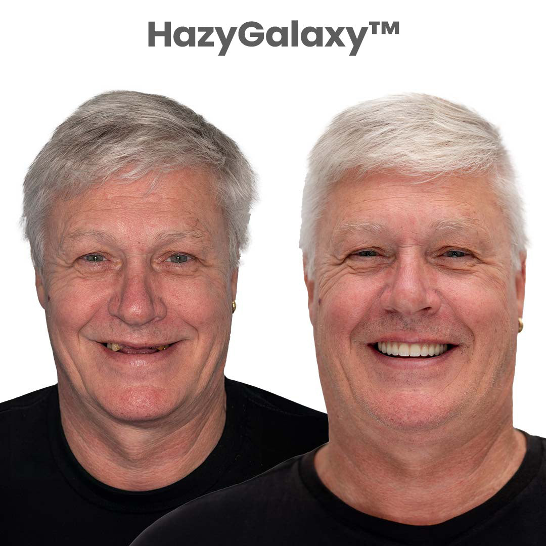 💥🦷 HazyGalaxy™ Custom-Fit Dentures ⏰ ENDS TODAY   70% OFF | Smile with Confidence